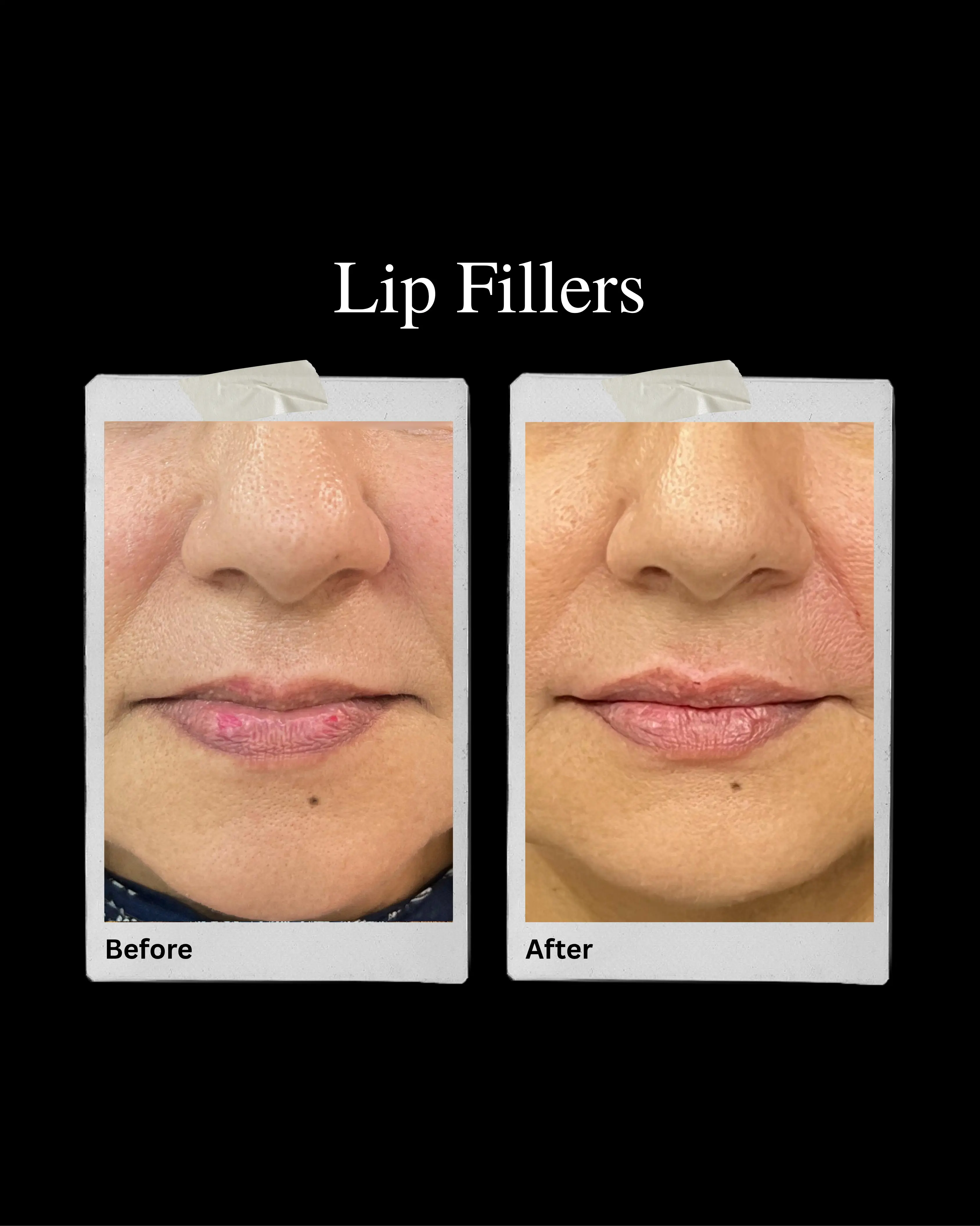 Client Transformation 5