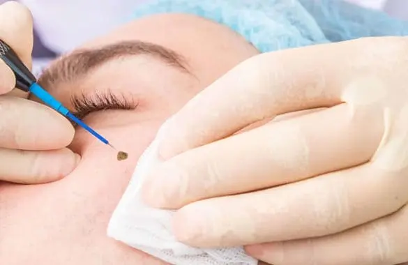 Surgical Dermatology