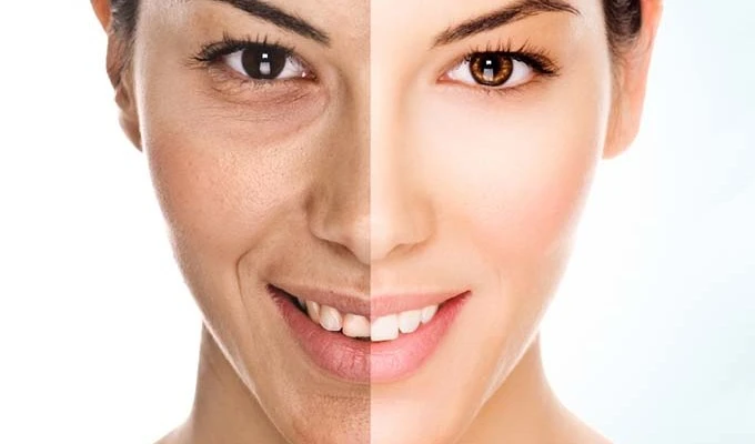 Anti-Aging Treatment